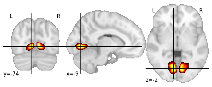 Component 62: Lingual gyrus middle