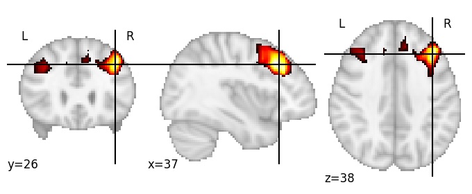Component 67: Middle frontal gyrus middle RH