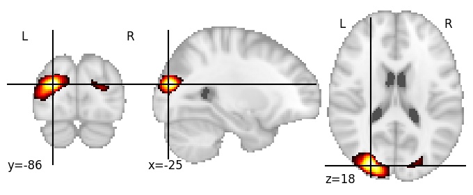 Component 8: Lateral occipital cortex LH