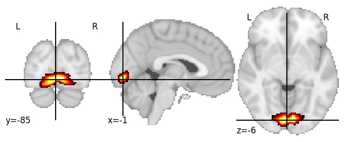 Component 78: Lingual gyrus mid-posterior