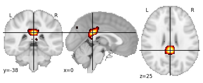 Component 90: Posterior cingulate cortex middle