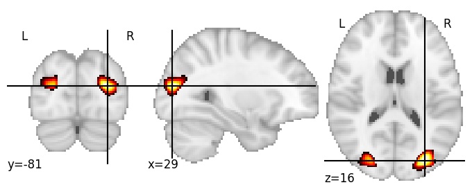 Component 2: Superior occipital gyrus 