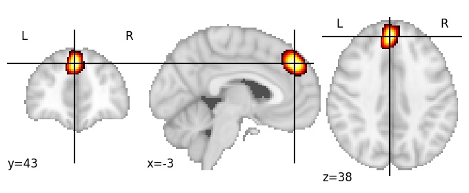 Component 104: Dorsomedial prefrontal cortex LH