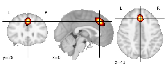 Component 117: Dorsomedial prefrontal cortex posterior