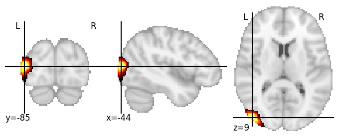 Component 134: Lateral occipital cortex posterior LH