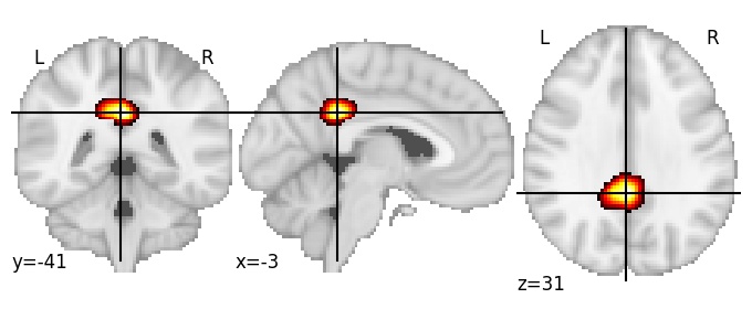 Component 142: Posterior cingulate cortex LH