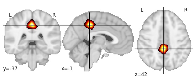Component 152: Posterior cingulate cortex superior
