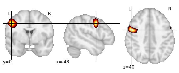 Component 169: Precentral gyrus middle LH