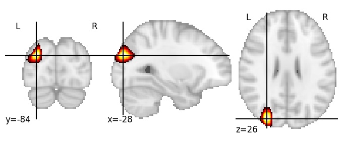 Component 172: Superior occipital gyrus LH