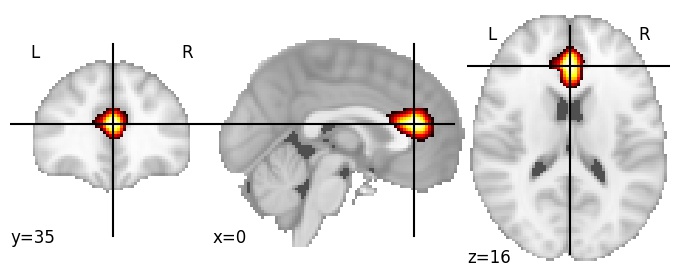 Component 186: Anterior cingulate cortex