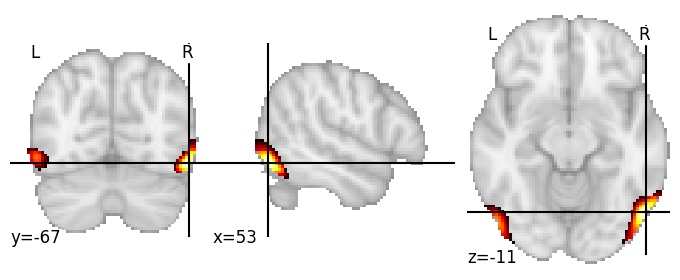 Component 187: Inferior occipital gyrus