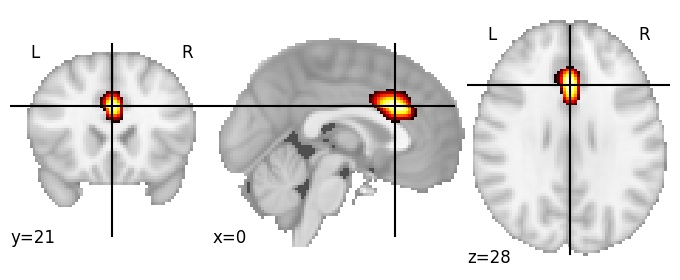 Component 220: Anterior cingulate cortex superior