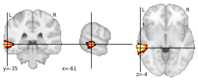 Component 230: Middle temporal gyrus middle posterior LH