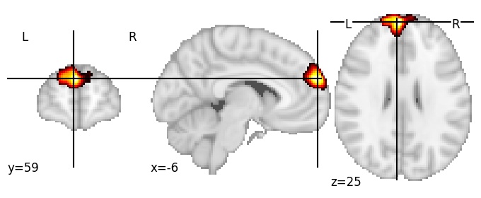 Component 24: Dorsomedial prefrontal cortex antero-superior LH