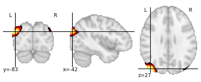 Component 238: Lateral occipital cortex superior LH