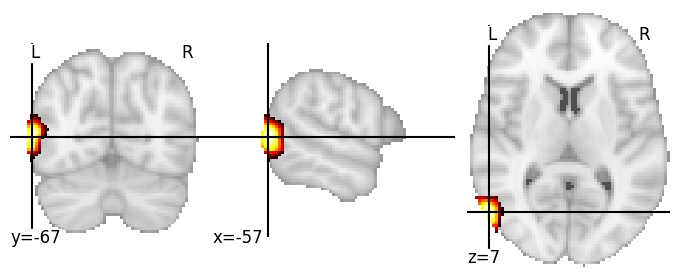 Component 243: Middle temporal gyrus posterior LH