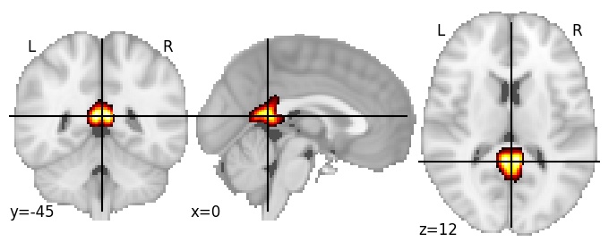 Component 250: Retrosplenial cortex superior