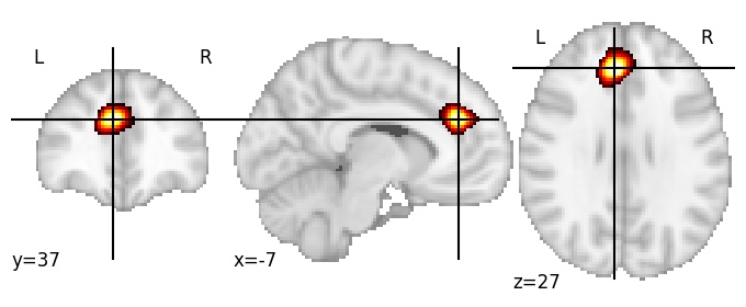 Component 271: Paracingulate gyrus mid-anterior LH
