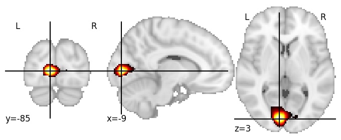 Component 296: Calcarine cortex mid-posterior LH