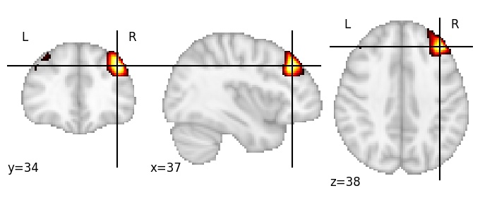 Component 4: Middle frontal gyrus middle RH