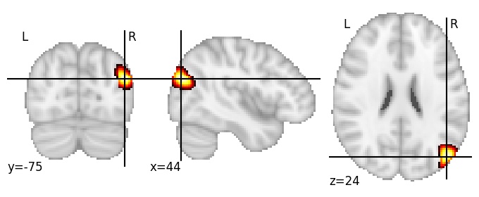 Component 315: Lateral occipital cortex superior RH