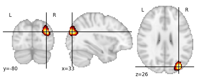 Component 347: Superior occipital gyrus inferior RH