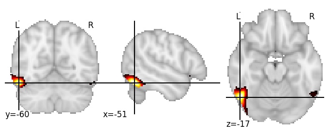 Component 349: Inferior occipital gyrus anterior LH