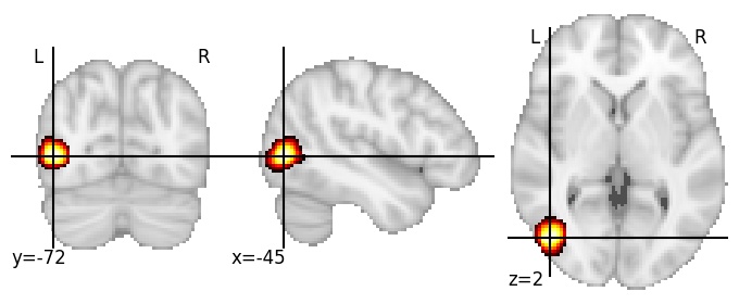 Component 352: Lateral occipital cortex anterior LH