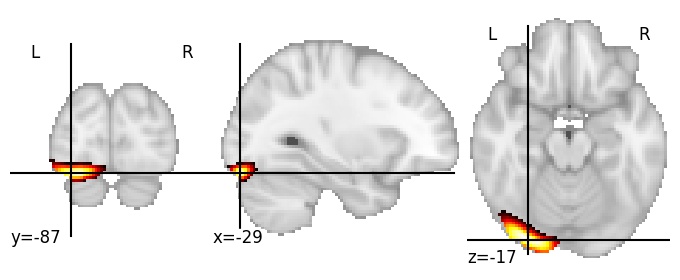 Component 363: Inferior occipital gyrus posterior LH