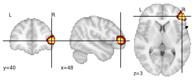 Component 366: Inferior frontal gyrus anterior RH