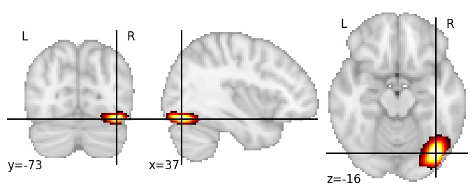 Component 370: Inferior occipital gyrus RH