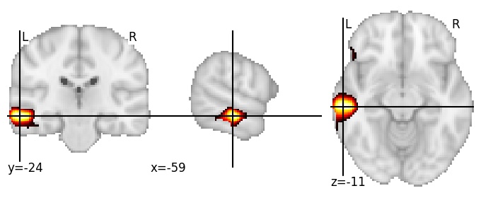 Component 379: Middle temporal gyrus middle anterior LH