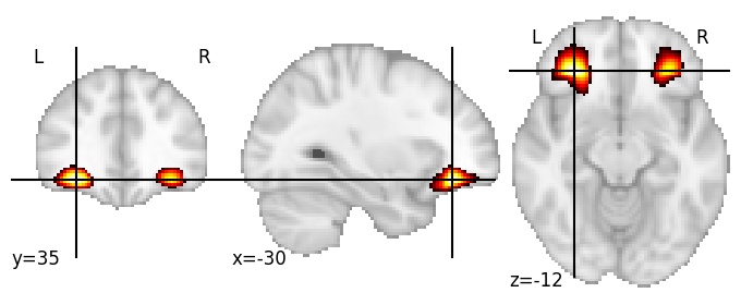 Component 490: Orbitofrontal cortex