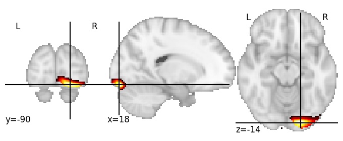 Component 498: Inferior occipital gyrus posterior RH