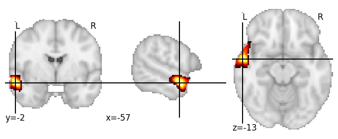 Component 66: Superior temporal gyrus mid-anterior LH