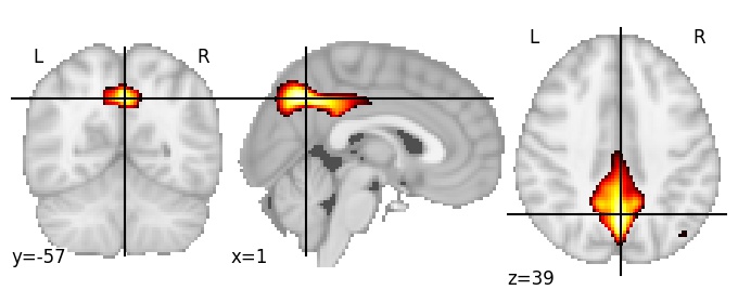 Component 14: Cingulate gyrus mid-posterior