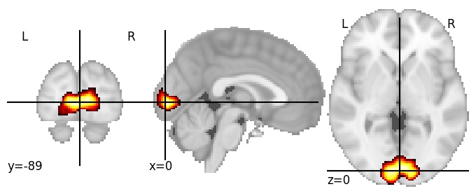 Component 3: Calcarine cortex posterior
