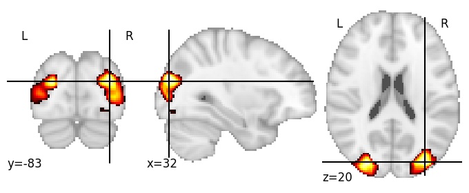 Component 24: Descending occipital gyrus