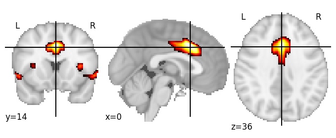 Component 26: Cingulate gyrus mid-anterior