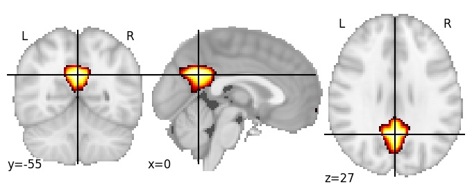 Component 4: Cingulate cortex posterior