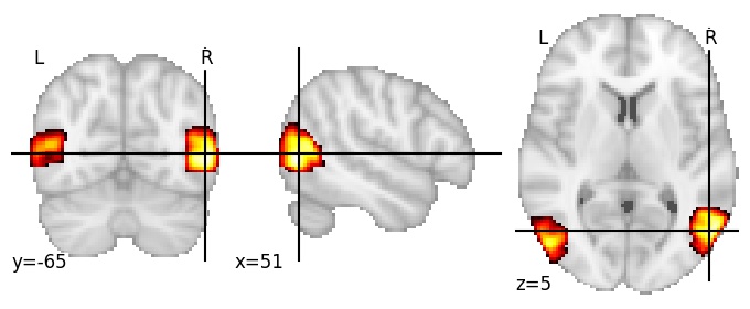 Component 42: Lateral occipital cortex
