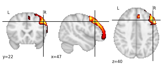Component 51: Middle frontal gyrus
