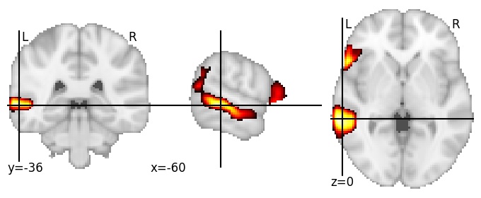 Component 61: Middle temporal gyrus