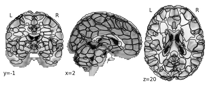 operculum brain of the l