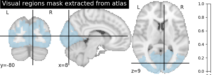 ../_images/sphx_glr_plot_alignment_methods_benchmark_001.png