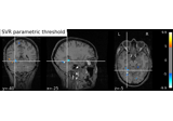 Support recovery on fMRI data